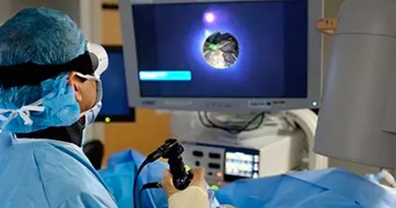Cálculos Renais: Tratamento a Laser com Tecnologia e Precisão